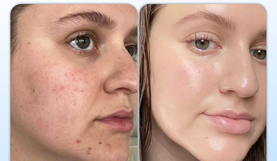 Clean Skin Club Clean Towels XL disposable face towels made from 100% USDA Biobased material for facial cleansing, skincare, and makeup removal.