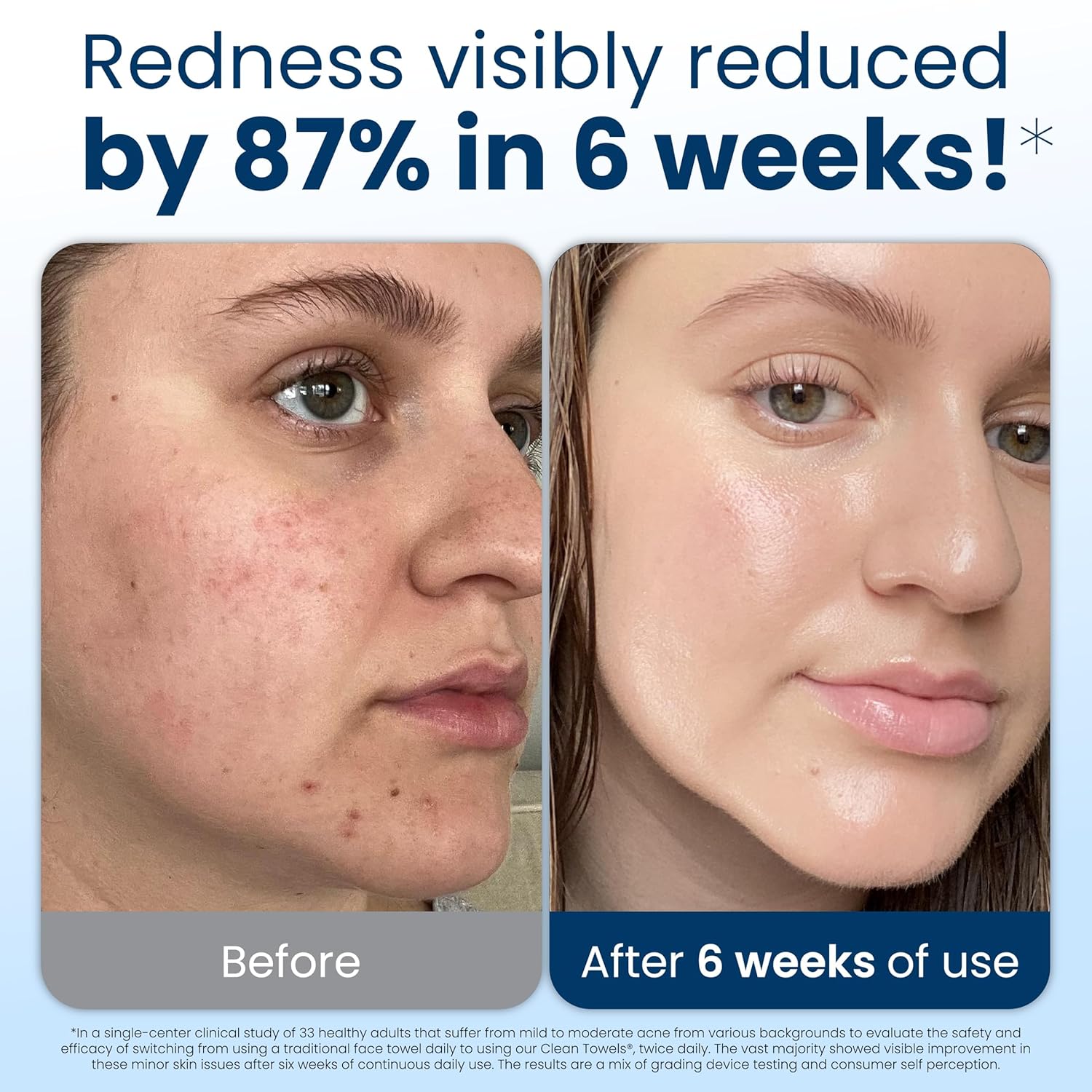 Clean Skin Club Clean Towels XL disposable face towels made from 100% USDA Biobased material for facial cleansing, skincare, and makeup removal.