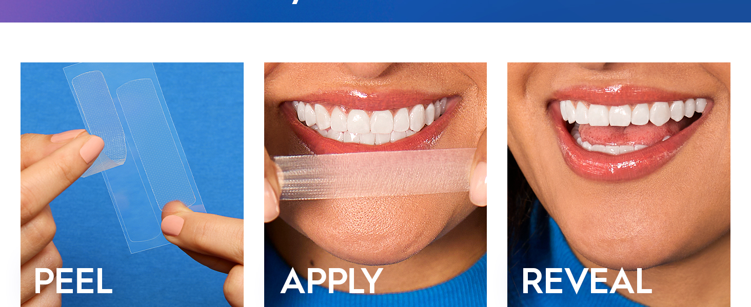 Crest 3D Whitestrips Professional Effects teeth whitening kit with 22 treatments and 44 whitening strips for at-home whitening