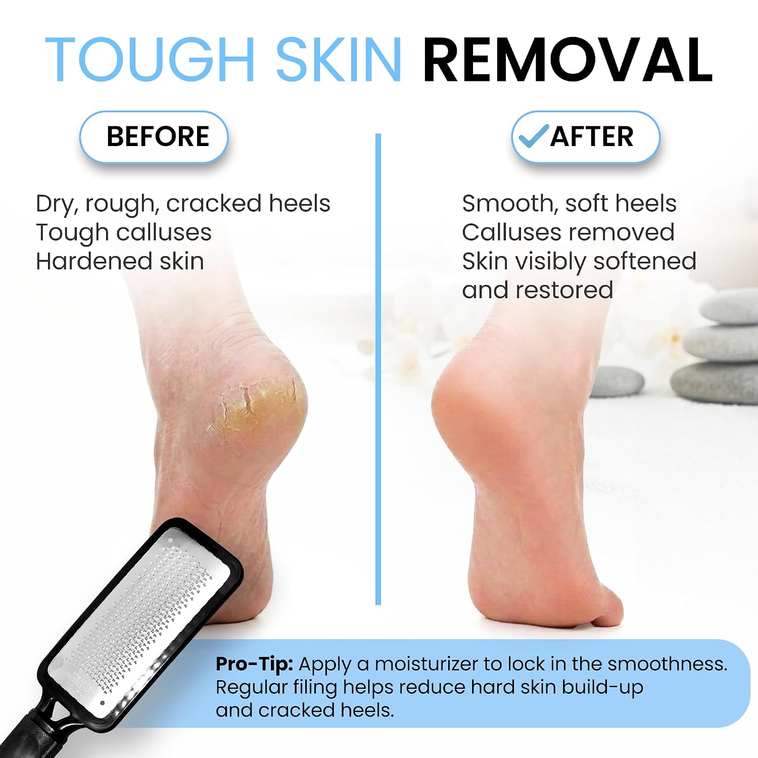 Colossal Foot Rasp Foot File and Callus Remover with stainless steel metal surface for removing hard skin on wet and dry feet