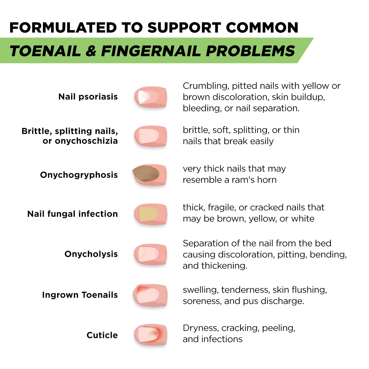 Footcure Antifungal Nail Treatment Pen with 25 percent undecylenic acid tea tree oil and oregano oil for toenail and fingernail care