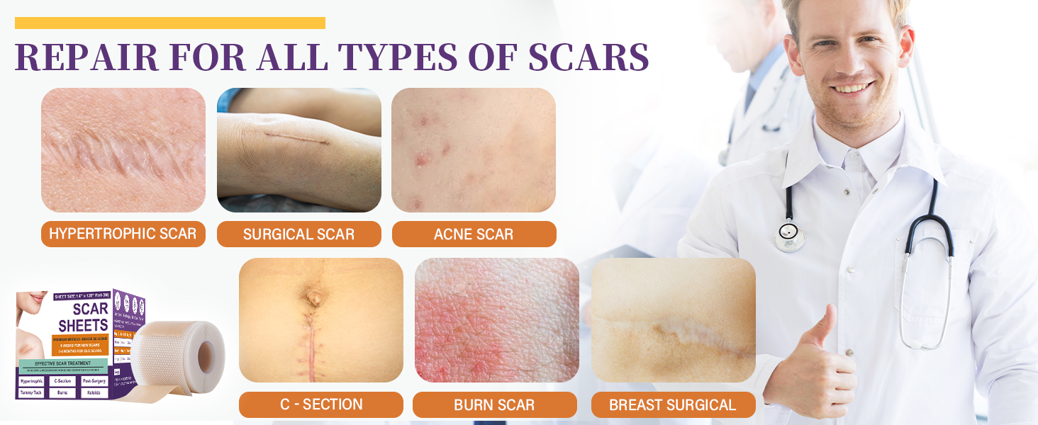 Medical grade reusable silicone scar sheets roll for surgical C-section burn keloid and hypertrophic scar care