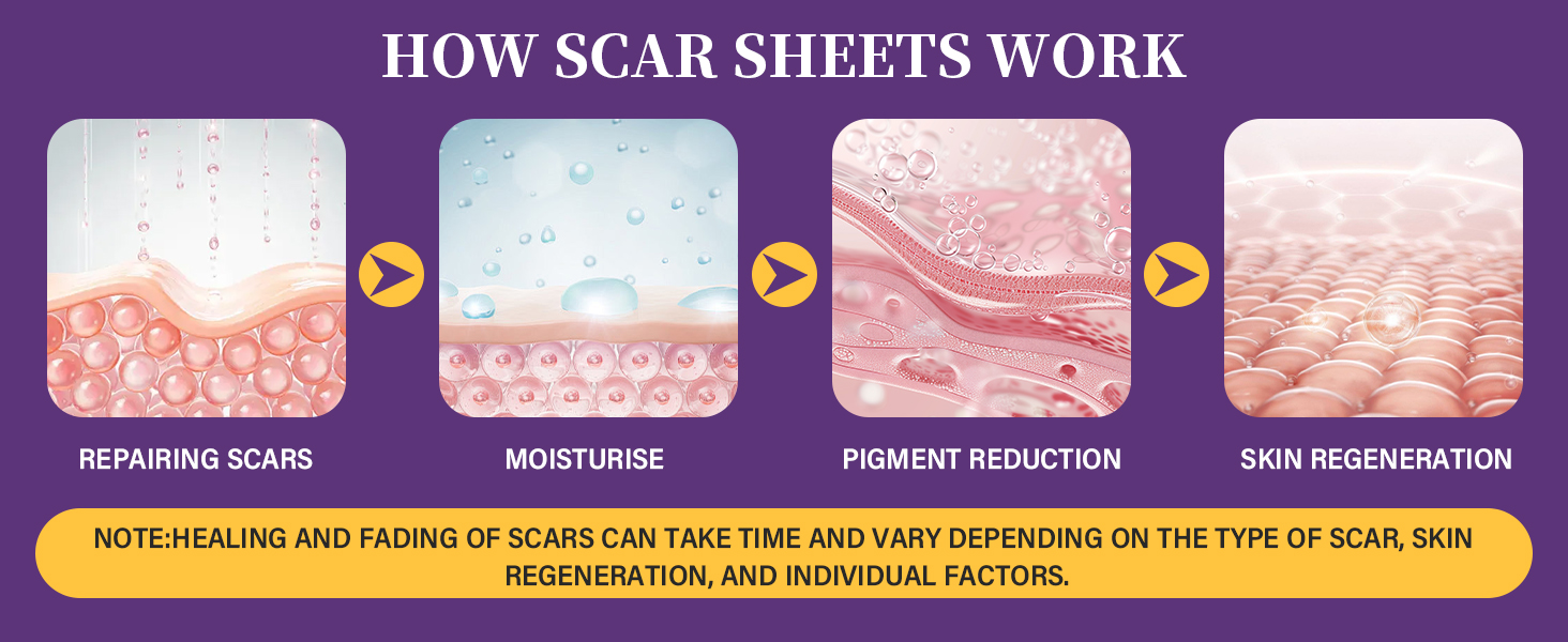 Medical grade reusable silicone scar sheets roll for surgical C-section burn keloid and hypertrophic scar care