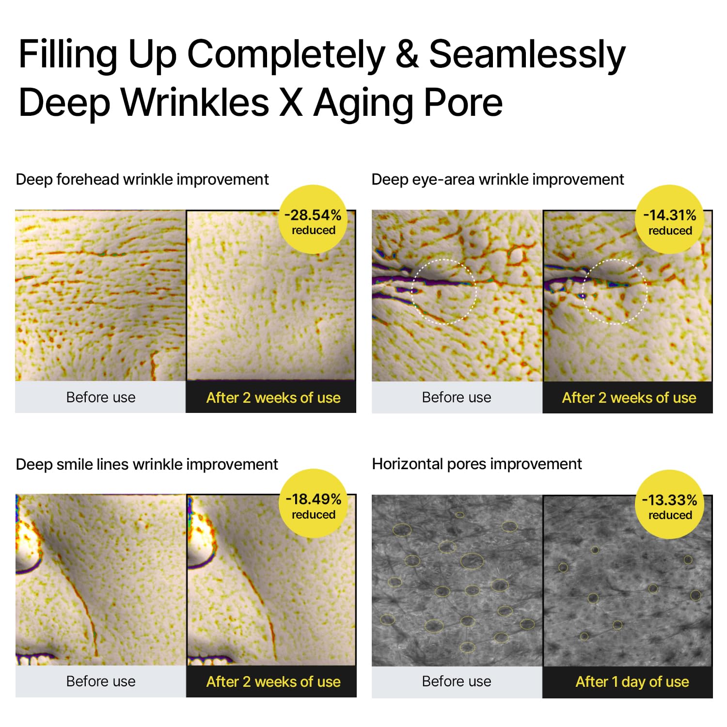 celimax The Vita A Retinal Shot Tightening Booster with 0.1 percent Retinal and 3 percent Matrixyl Korean anti-aging skincare serum