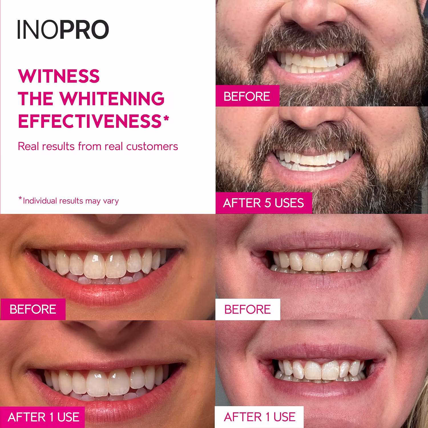 InoPro Green Peroxide Free Teeth Whitening Strips 28 Count for Deep Stain Whitening