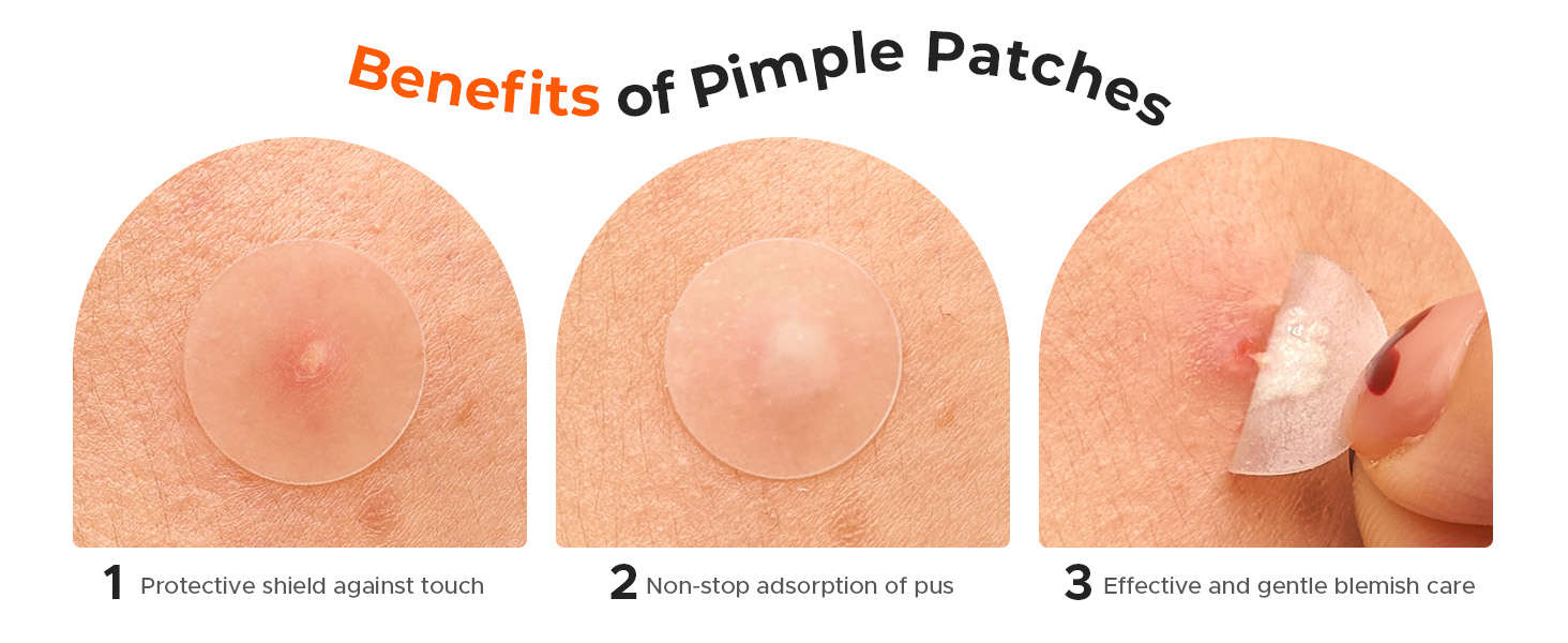 TKTK 443 Count Pimple Patches for Face Hydrocolloid Acne Cover Patch Bulk
