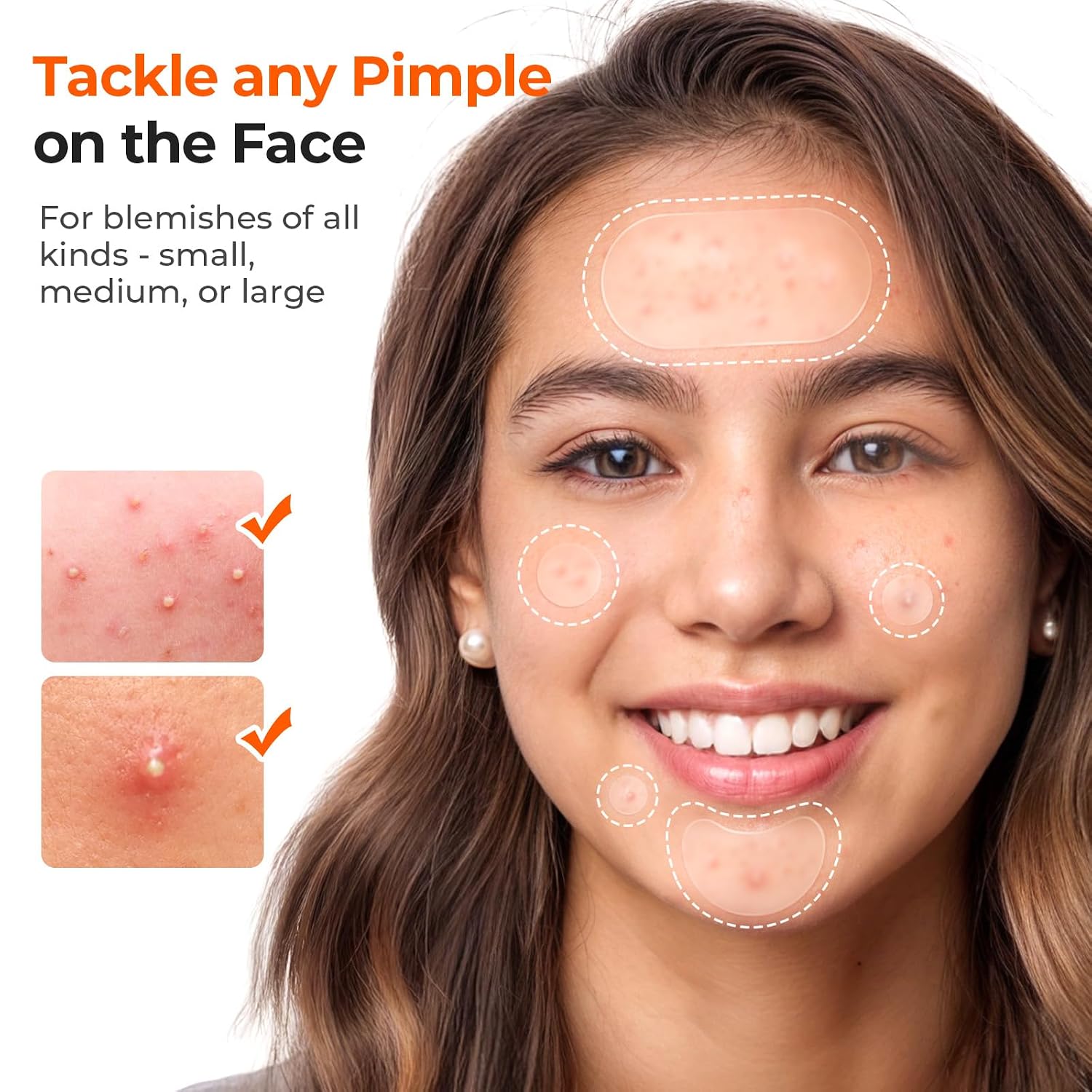 TKTK 443 Count Pimple Patches for Face Hydrocolloid Acne Cover Patch Bulk
